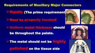 Rigidity
Must be properly located
Uniform metal thickness should
be throughout the palate.
The metal should not be highly
polished on the tissue side
Requirements of Maxillary Major Connectors
(The prime requirement)
 