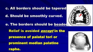 c. All borders should be tapered
d. Should be smoothly curved.
e. The borders should be beaded.
Relief is avoided except in the
presence of palatal tori or
prominent median palatine
raphe.
 