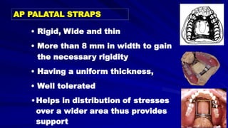 • Rigid, Wide and thin
• More than 8 mm in width to gain
the necessary rigidity
• Having a uniform thickness,
• Well tolerated
•Helps in distribution of stresses
over a wider area thus provides
support
AP PALATAL STRAPS
 