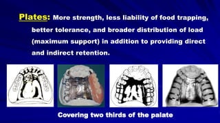 Plates: More strength, less liability of food trapping,
better tolerance, and broader distribution of load
(maximum support) in addition to providing direct
and indirect retention.
Covering two thirds of the palate
 