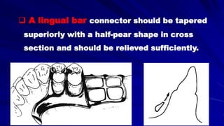  A lingual bar connector should be tapered
superiorly with a half-pear shape in cross
section and should be relieved sufficiently.
 