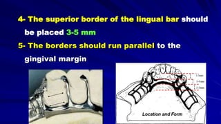 4- The superior border of the lingual bar should
be placed 3-5 mm
5- The borders should run parallel to the
gingival margin
 