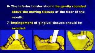 6- The inferior border should be gently rounded
above the moving tissues of the floor of the
mouth.
7- Impingement of gingival tissues should be
avoided.
 