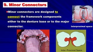Interproximal space
9. Minor Connectors
Minor connectors are designed to
connect the framework components
either to the denture base or to the major
connector.
 