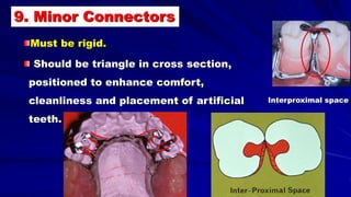 Interproximal space
9. Minor Connectors
Must be rigid.
Should be triangle in cross section,
positioned to enhance comfort,
cleanliness and placement of artificial
teeth.
 