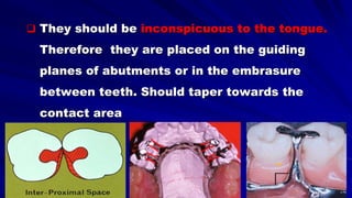  They should be inconspicuous to the tongue.
Therefore they are placed on the guiding
planes of abutments or in the embrasure
between teeth. Should taper towards the
contact area
 