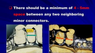  There should be a minimum of 4 - 5mm
space between any two neighboring
minor connectors.
 