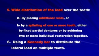 5. Wide distribution of the load over the teeth:
a- By placing additional rests, or
b- by a splinting of one or more teeth, either
by fixed partial dentures or by soldering
two or more individual restoration together.
6- Using a Kennedy bar to distribute the
lateral load on multiple teeth.
 