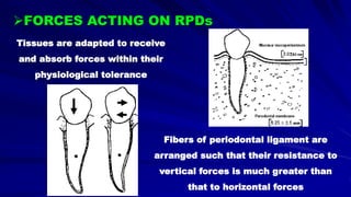 Fibers of periodontal ligament are
arranged such that their resistance to
vertical forces is much greater than
that to horizontal forces
Tissues are adapted to receive
and absorb forces within their
physiological tolerance
FORCES ACTING ON RPDs
 