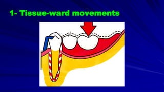 1- Tissue-ward movements
 