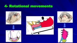 4- Rotational movements
 
