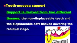Tooth-mucosa support
Support is derived from two different
tissues, the non-displaceable teeth and
the displaceable soft tissues covering the
residual ridge.
 