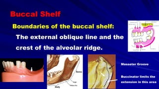 Boundaries of the buccal shelf:
The external oblique line and the
crest of the alveolar ridge.
Buccal Shelf
Masseter Groove
Buccinator limits the
extension in this area
 