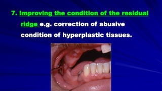 7. Improving the condition of the residual
ridge e.g. correction of abusive
condition of hyperplastic tissues.
 