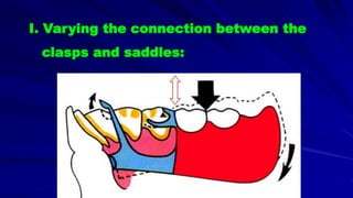 I. Varying the connection between the
clasps and saddles:
 