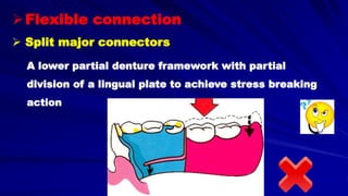  Split major connectors
A lower partial denture framework with partial
division of a lingual plate to achieve stress breaking
action
Flexible connection
 