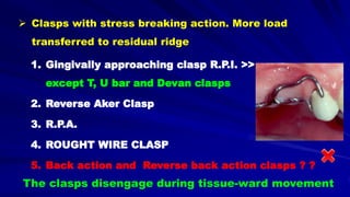 1. Gingivally approaching clasp R.P.I. >>
except T, U bar and Devan clasps
2. Reverse Aker Clasp
3. R.P.A.
4. ROUGHT WIRE CLASP
5. Back action and Reverse back action clasps ? ?
 Clasps with stress breaking action. More load
transferred to residual ridge
The clasps disengage during tissue-ward movement
 