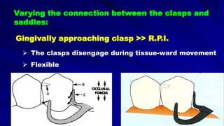Varying the connection between the clasps and
saddles:
Gingivally approaching clasp >> R.P.I.
 The clasps disengage during tissue-ward movement
 Flexible
 