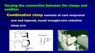 Varying the connection between the clasps and
saddles:
Combination clasp consists of cast reciprocal
arm and tapered, round wrought-wire retentive
clasp arm
 