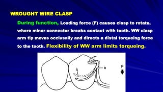 WROUGHT WIRE CLASP
During function, Loading force (F) causes clasp to rotate,
where minor connector breaks contact with tooth. WW clasp
arm tip moves occlusally and directs a distal torqueing force
to the tooth. Flexibility of WW arm limits torqueing.
 