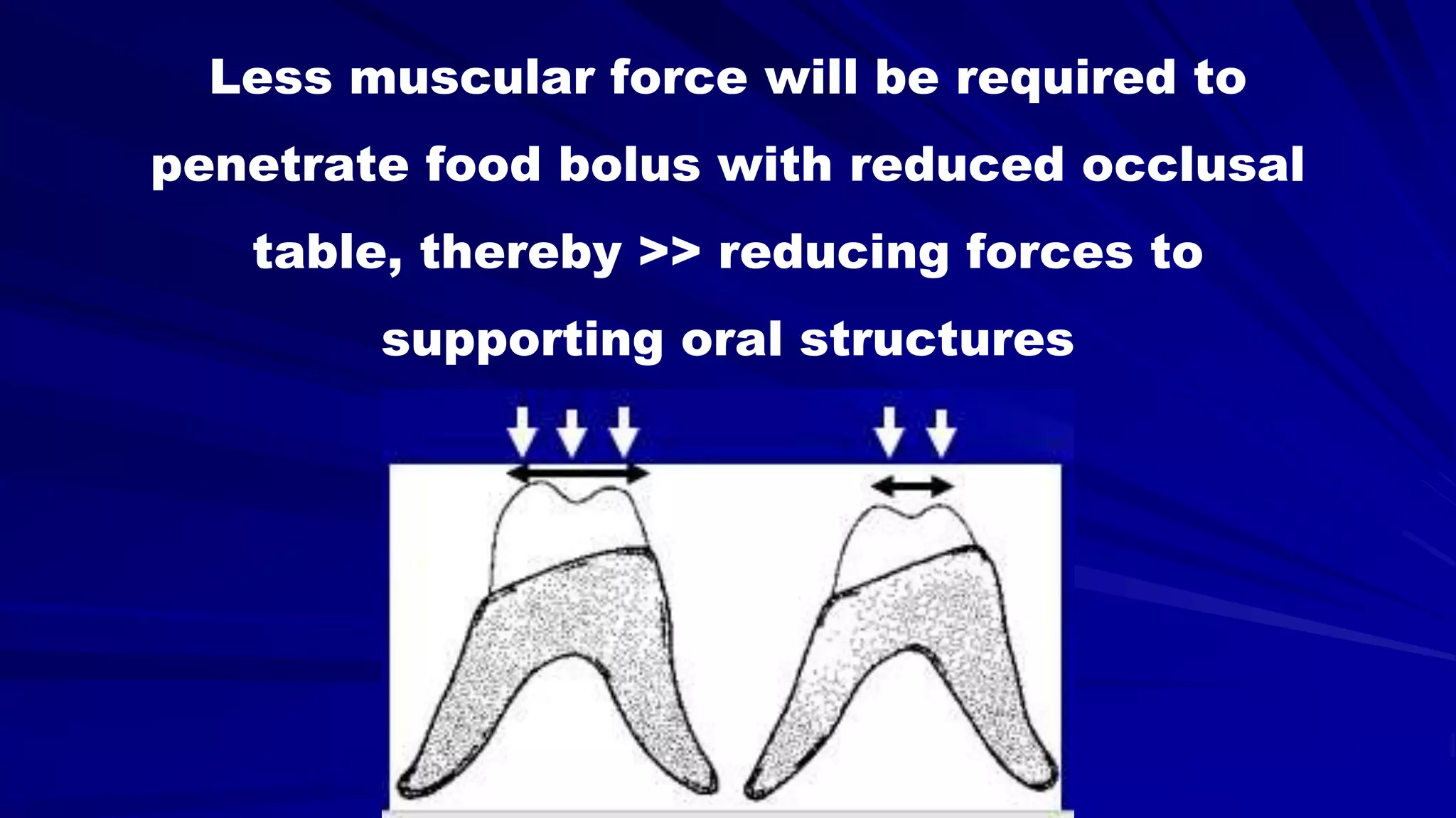 5- Basic principles for designing the removable partial denture (class i partial denture design)