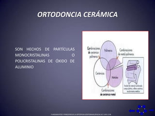 ORTODONCIA CERÁMICASON HECHOS DE PARTÍCULAS MONOCRISTALINAS O POLICRISTALINAS DE ÓXIDO DE ALUMINIOFUNDAMENTOS Y PRINCIPIOS DE LA ORTOPEDIA DENTOMAXILOFACIAL 617, 643: 0-36