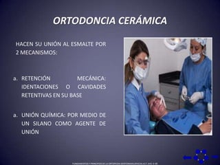 ORTODONCIA CERÁMICAHACEN SU UNIÓN AL ESMALTE POR 2 MECANISMOS: RETENCIÓN MECÁNICA: IDENTACIONES O CAVIDADES RETENTIVAS EN SU BASEUNIÓN QUÍMICA: POR MEDIO DE UN SILANO COMO AGENTE DE UNIÓNFUNDAMENTOS Y PRINCIPIOS DE LA ORTOPEDIA DENTOMAXILOFACIAL 617, 643: 0-36