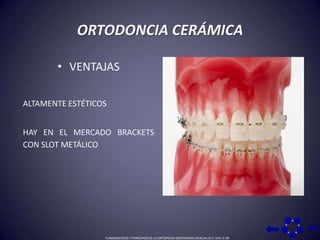 ORTODONCIA CERÁMICAVENTAJAS ALTAMENTE ESTÉTICOSHAY EN EL MERCADO BRACKETS CON SLOT METÁLICO FUNDAMENTOS Y PRINCIPIOS DE LA ORTOPEDIA DENTOMAXILOFACIAL 617, 643: 0-36