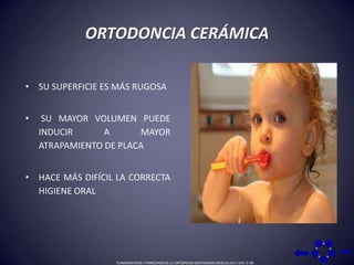 ORTODONCIA CERÁMICASU SUPERFICIE ES MÁS RUGOSA SU MAYOR VOLUMEN PUEDE INDUCIR A MAYOR ATRAPAMIENTO DE PLACAHACE MÁS DIFÍCIL LA CORRECTA HIGIENE ORAL FUNDAMENTOS Y PRINCIPIOS DE LA ORTOPEDIA DENTOMAXILOFACIAL 617, 643: 0-36