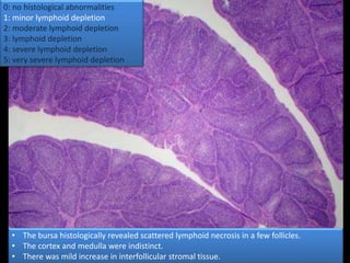 0: no histological abnormalities
1: minor lymphoid depletion
2: moderate lymphoid depletion
3: lymphoid depletion
4: severe lymphoid depletion
5: very severe lymphoid depletion
• The bursa histologically revealed scattered lymphoid necrosis in a few follicles.
• The cortex and medulla were indistinct.
• There was mild increase in interfollicular stromal tissue.
 