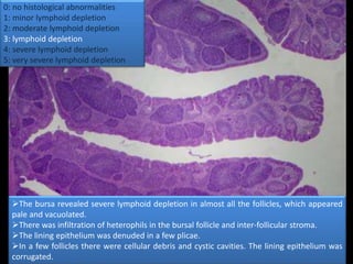0: no histological abnormalities
1: minor lymphoid depletion
2: moderate lymphoid depletion
3: lymphoid depletion
4: severe lymphoid depletion
5: very severe lymphoid depletion
The bursa revealed severe lymphoid depletion in almost all the follicles, which appeared
pale and vacuolated.
There was infiltration of heterophils in the bursal follicle and inter-follicular stroma.
The lining epithelium was denuded in a few plicae.
In a few follicles there were cellular debris and cystic cavities. The lining epithelium was
corrugated.
 