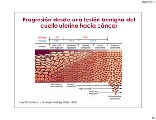 5. cáncer de cuello uterino
