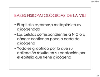 5. cáncer de cuello uterino