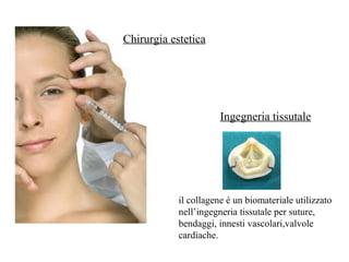 Chirurgia estetica
il collagene è un biomateriale utilizzato
nell’ingegneria tissutale per suture,
bendaggi, innesti vascolari,valvole
cardiache.
Ingegneria tissutale
 