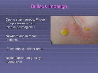 Cleaved Skin Dermatology - common skin infections by Dr. Eman | PPT