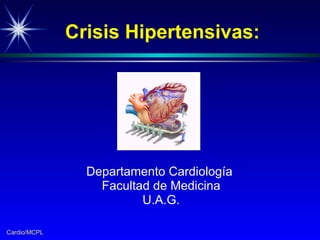 Crisis Hipertensivas: Departamento Cardiología  Facultad de Medicina U.A.G. 