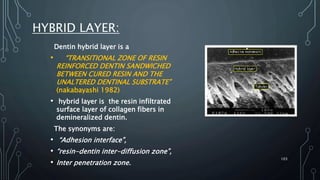 HYBRID LAYER:
Dentin hybrid layer is a
• “TRANSITIONAL ZONE OF RESIN
REINFORCED DENTIN SANDWICHED
BETWEEN CURED RESIN AND THE
UNALTERED DENTINAL SUBSTRATE”
(nakabayashi 1982)
• hybrid layer is the resin infiltrated
surface layer of collagen fibers in
demineralized dentin.
The synonyms are:
• “Adhesion interface”,
• “resin-dentin inter-diffusion zone”,
• Inter penetration zone.
103
 