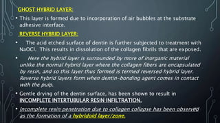 GHOST HYBRID LAYER:
• This layer is formed due to incorporation of air bubbles at the substrate
adhesive interface.
REVERSE HYBRID LAYER:
• The acid etched surface of dentin is further subjected to treatment with
NaOCl. This results in dissolution of the collagen fibrils that are exposed.
• Here the hybrid layer is surrounded by more of inorganic material
unlike the normal hybrid layer where the collagen fibers are encapsulated
by resin, and so this layer thus formed is termed reversed hybrid layer.
Reverse hybrid layers form when dentin-bonding agent comes in contact
with the pulp.
• Gentle drying of the dentin surface, has been shown to result in
INCOMPLETE INTERTUBULAR RESIN INFILTRATION.
• Incomplete resin penetration due to collagen collapse has been observed
as the formation of a hybridoid layer/zone.
107
 