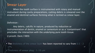 Smear Layer
When the tooth surface is instrumented with rotary and manual
instrument during cavity preparations, cutting debris is smeared over the
enamel and dentinal surfaces forming what is termed as smear layer.
Definition :
Any debris, calcific in nature, produced by reduction or
instrumentation of dentin, enamel or cementum or as a ‘contaminant’ that
precludes the interaction with the underlying pure tooth tissue.
(J prosth. Dent.1989)
• The thickness of the smear layer has been reported to vary from 0.5 – 2
m.
• Thickness of smear plug : 1-10 m
67
 