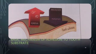 BASIC MECHANISM OF ADHESION TO TOOTH
SUBSTRATE
80
 