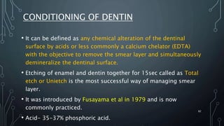 CONDITIONING OF DENTIN
• It can be defined as any chemical alteration of the dentinal
surface by acids or less commonly a calcium chelator (EDTA)
with the objective to remove the smear layer and simultaneously
demineralize the dentinal surface.
• Etching of enamel and dentin together for 15sec called as Total
etch or Unietch is the most successful way of managing smear
layer.
• It was introduced by Fusayama et al in 1979 and is now
commonly practiced.
• Acid- 35-37% phosphoric acid.
82
 