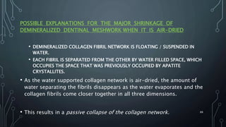 POSSIBLE EXPLANATIONS FOR THE MAJOR SHRINKAGE OF
DEMINERALIZED DENTINAL MESHWORK WHEN IT IS AIR-DRIED
• DEMINERALIZED COLLAGEN FIBRIL NETWORK IS FLOATING / SUSPENDED IN
WATER.
• EACH FIBRIL IS SEPARATED FROM THE OTHER BY WATER FILLED SPACE, WHICH
OCCUPIES THE SPACE THAT WAS PREVIOUSLY OCCUPIED BY APATITE
CRYSTALLITES.
• As the water supported collagen network is air-dried, the amount of
water separating the fibrils disappears as the water evaporates and the
collagen fibrils come closer together in all three dimensions.
• This results in a passive collapse of the collagen network. 88
 