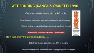 98
WET BONDING (KANCA & GWINETT) 1990
Once etched dentin should be left moist
Primer (Acetone) vaporizes the water-leaving the space for resin topenetrate
Optimal wetting of exposed collagen achieving high bond strength
Wet bonding Technique – Kanca & Gwinett 1990
▸How wet or dry the dentin should be……
Substrate should be neither too Wet or too dry
Excess water should be blotted with a dry sponge/ tissue paper
 