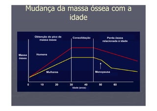 Mudança da massa óssea com a
idade
 