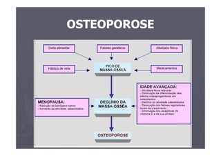 OSTEOPOROSE
 