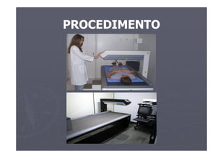 PROCEDIMENTO
 
