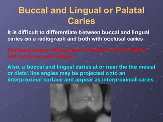 5-Dental Caries radiology in dentistry . | PPTX