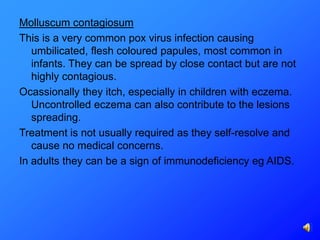 Molluscum contagiosum
This is a very common pox virus infection causing
   umbilicated, flesh coloured papules, most common in
   infants. They can be spread by close contact but are not
   highly contagious.
Ocassionally they itch, especially in children with eczema.
   Uncontrolled eczema can also contribute to the lesions
   spreading.
Treatment is not usually required as they self-resolve and
   cause no medical concerns.
In adults they can be a sign of immunodeficiency eg AIDS.
 