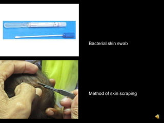 Bacterial skin swab




Method of skin scraping
 