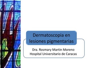 Dermatoscopia en lesiones pigmentarias Dra. Rosmary Martin Moreno Hospital Universitario de Caracas 